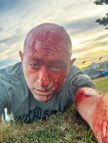 The Bondi Beach False Flag Attack – Snaphanen.dk