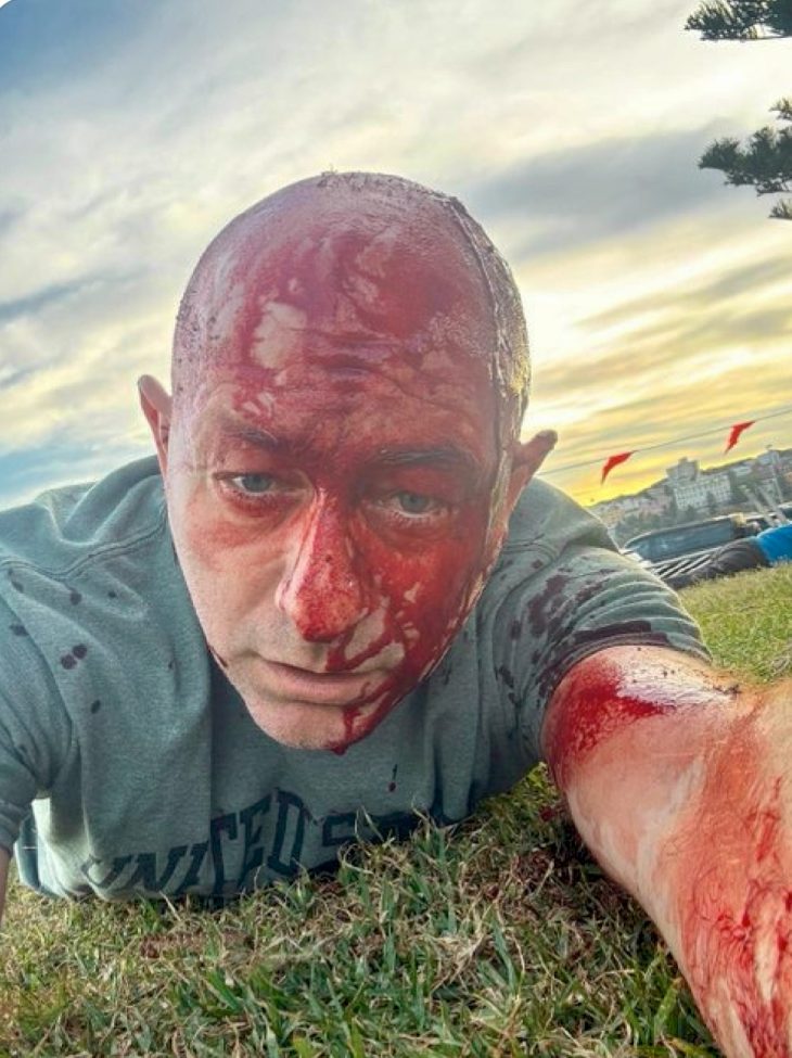 The Bondi Beach False Flag Attack – Snaphanen.dk